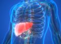 Getting ahead of liver cancer