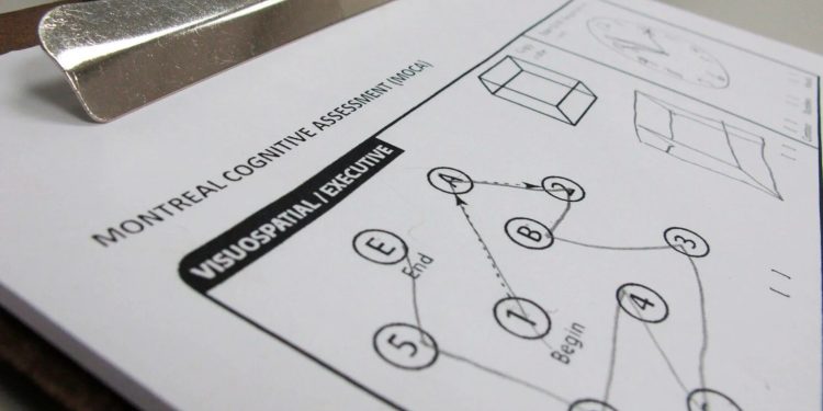 Testing fitness of aging brain