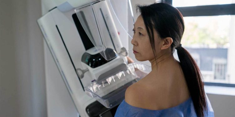 Warning for younger women: Be vigilant on breast cancer risk