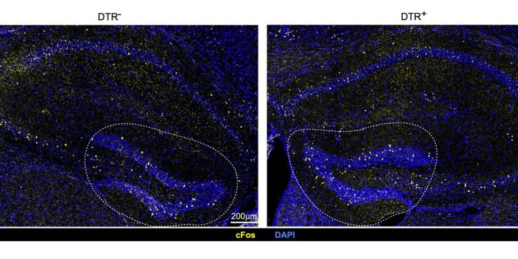 The brain’s gatekeepers