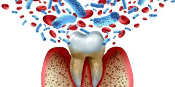 The gum disease, diabetes connection